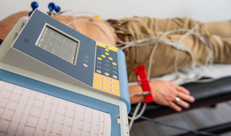EKG serca