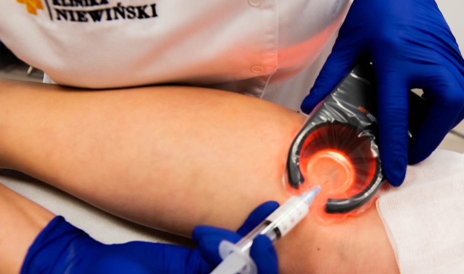 Skleroterapia torbieli Bakera